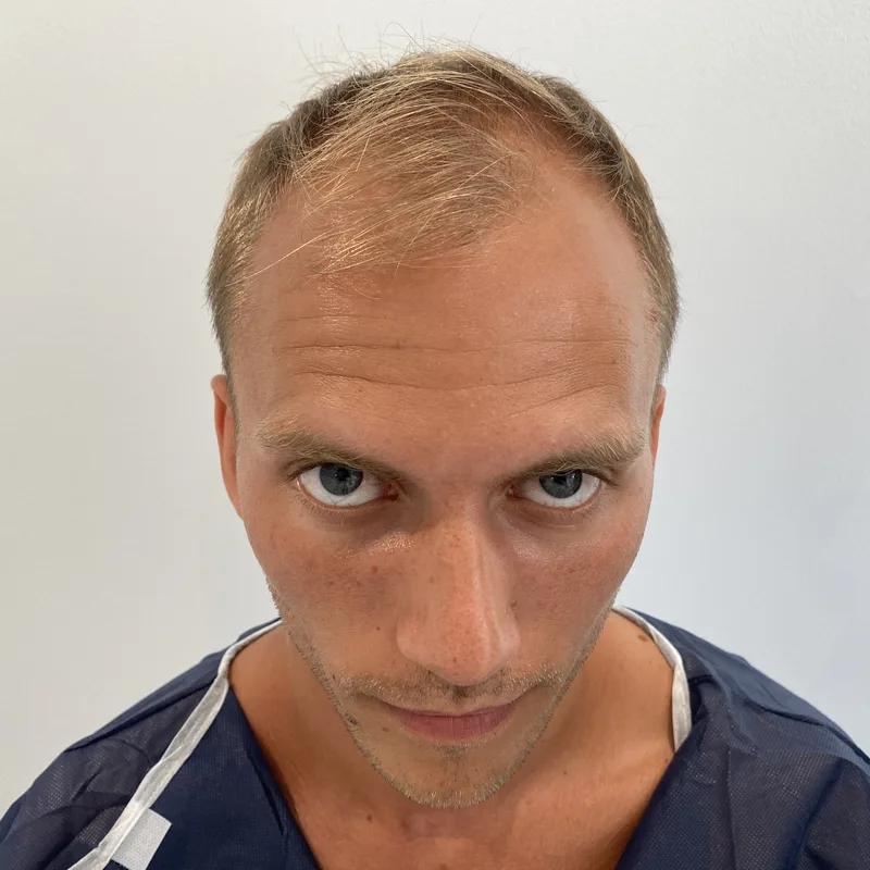 Simon Nackborn - Före